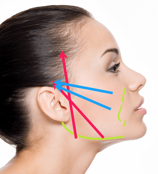 ひきあげイメージ