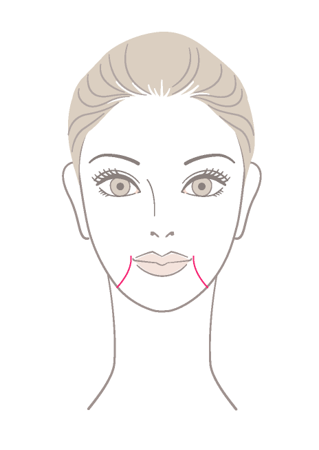 マリオネットライン